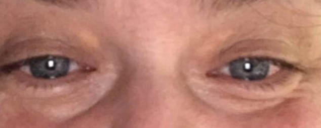 For højt kolesterol august 2020