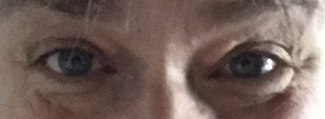 Forhøjtet kolesterol Juni