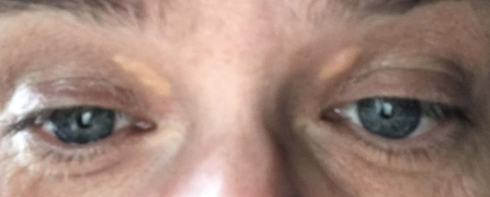 Efter et synde måltid