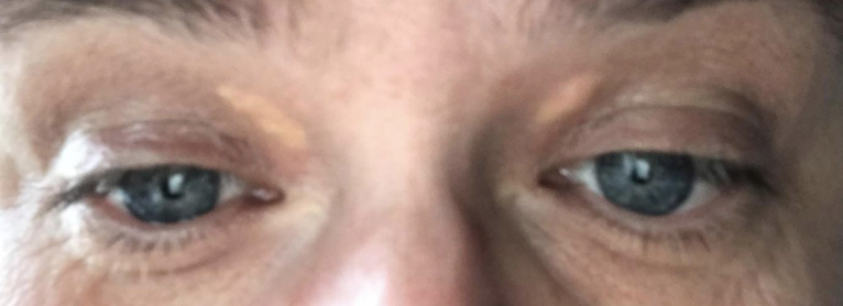 Efter et synde måltid